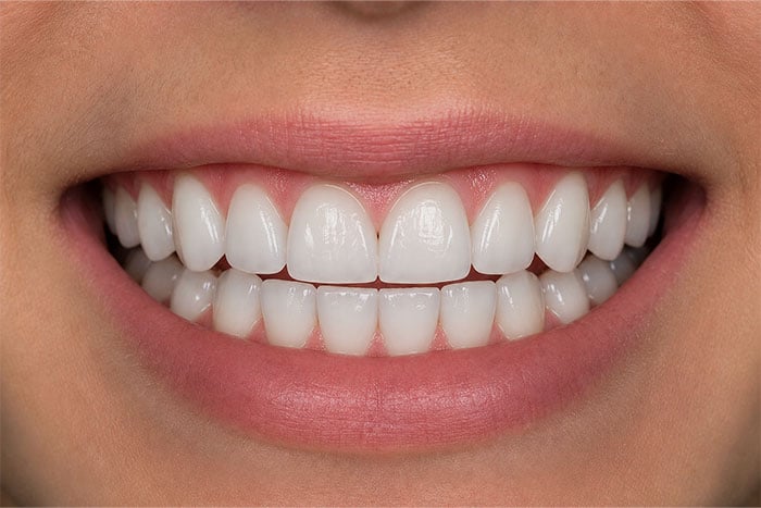 Cosmetic-Composite-Bonding-Path-after