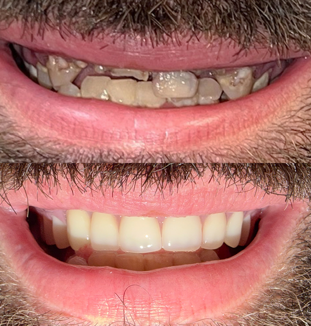 Edited Before and After (1) Edited Before and After (1)